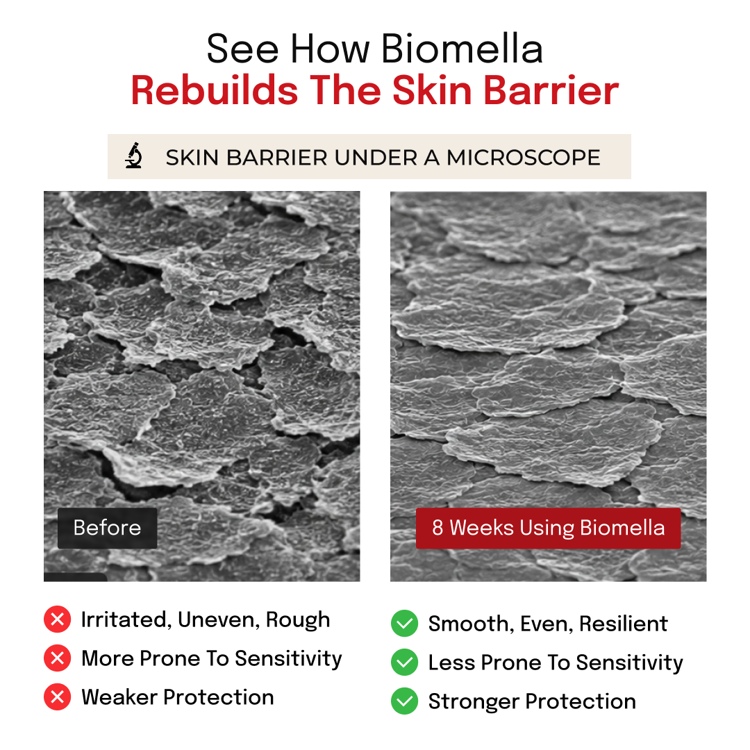 Infographic illustrating skin barrier repair with Biomella Postbiotic Face Cream