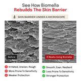 Infographic illustrating skin barrier repair with Biomella Postbiotic Face Cream