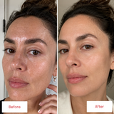 Before and after facial skin comparison showing changes in skin clarity and texture