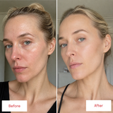 Before and after photos showing changes in facial skin appearance and texture