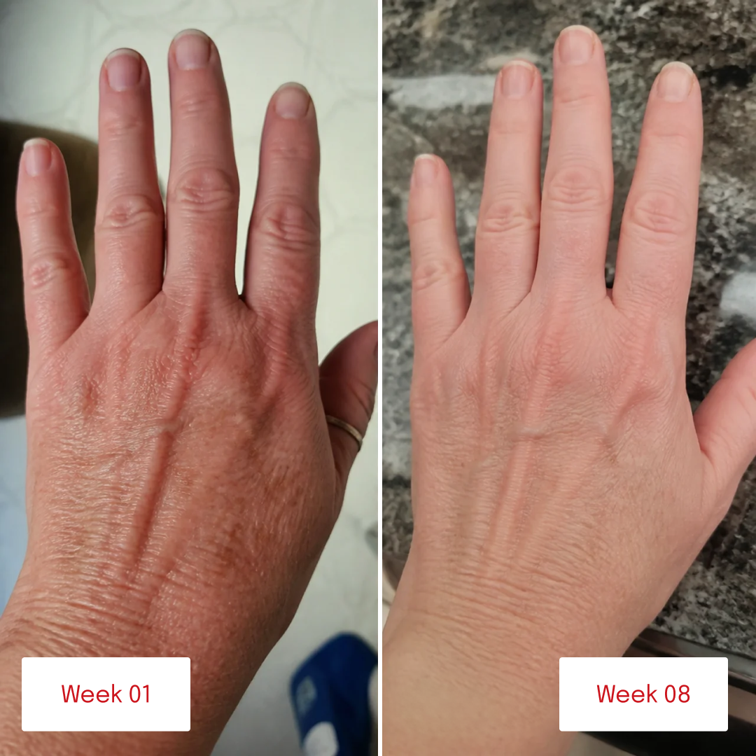 Before and after comparison of hands showing changes in skin tone and appearance