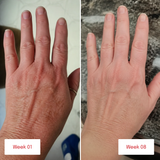 Before and after comparison of hands showing changes in skin tone and appearance
