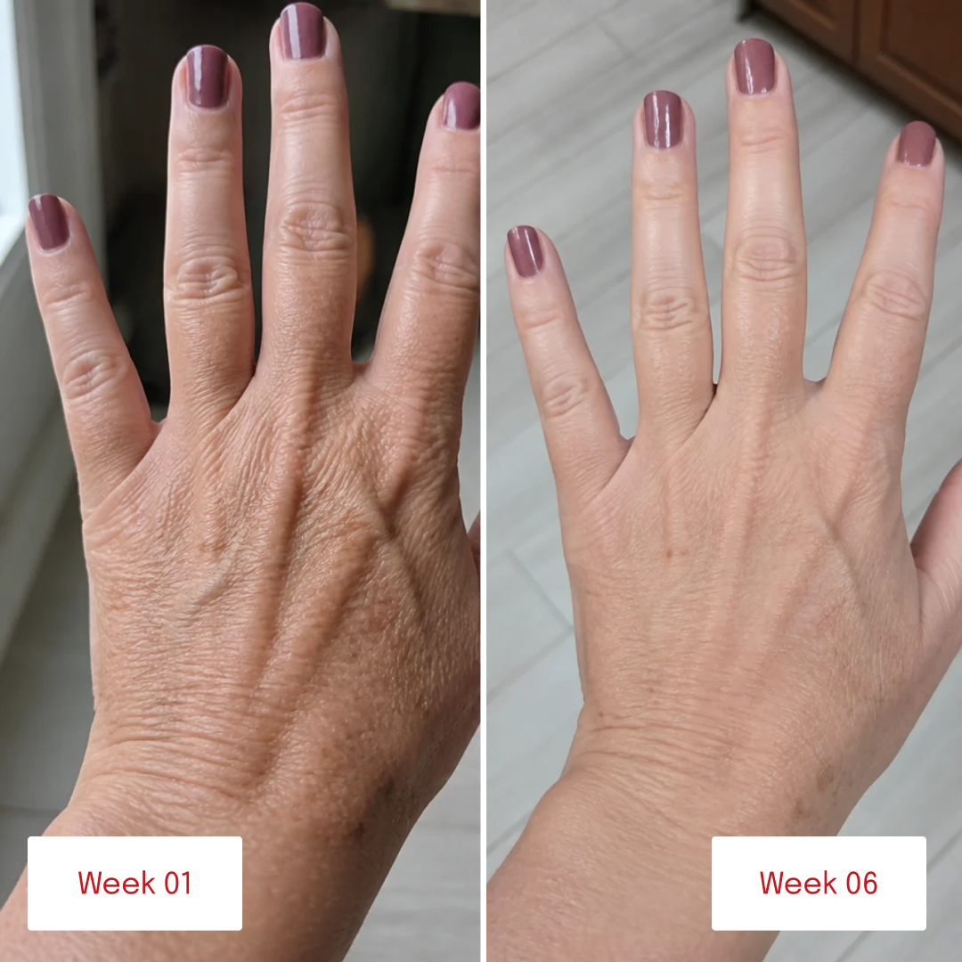 Before and after photos of hands showing changes in skin texture and appearance