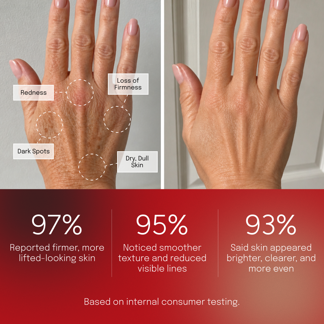 Before and after comparison of hands showing reduced dark spots and more even skin tone, with Biomella Dark Spot Hand Cream consumer study results
