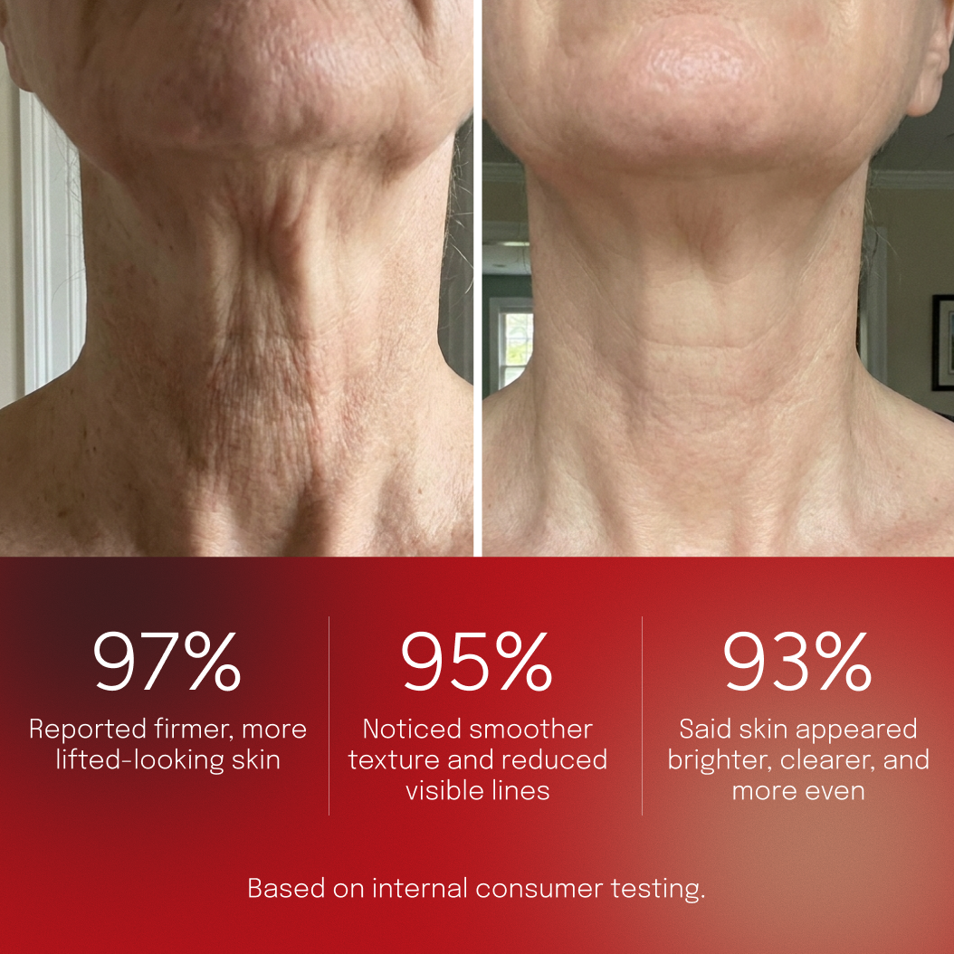 Before and after comparison of neck skin showing smoother texture and firmer-looking skin, alongside Biomella Postbiotic Neck Cream consumer study results